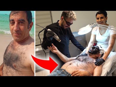 AMCAMA LAZER EPİLASYON YAPTIM *Ağladı 😢*