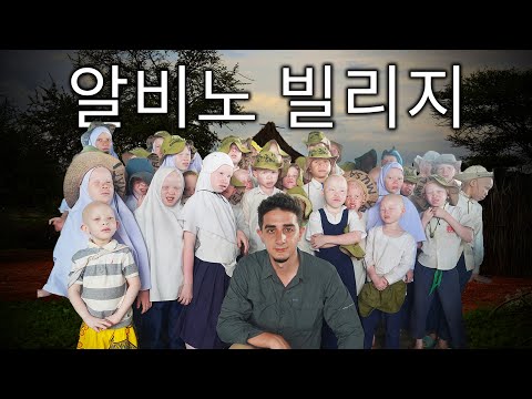 탄자니아의 비밀 마을, 알비노 마을에 가다 (살기엔 너무 하얗다)