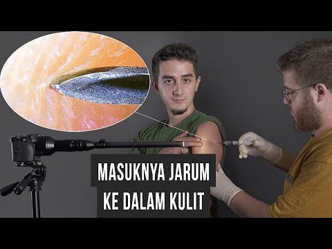 Saya Membidik Objek Sehari-Hari Secara Close-Up (Uji zoom 1000 kali)