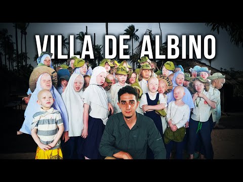Visitando il Villaggio Segreto degli Albini in Africa (Troppo Bianchi per Poter Vivere)