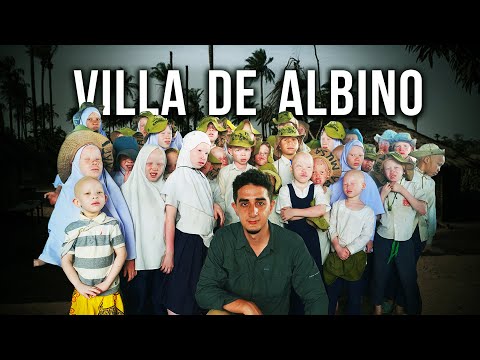 Visitando a Vila Secreta dos Albinos na África (Brancos Demais Para Viver)